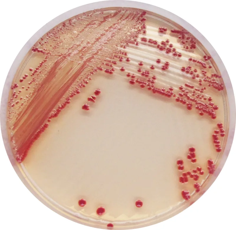 Acinetobacter baumannii found on medical equipment