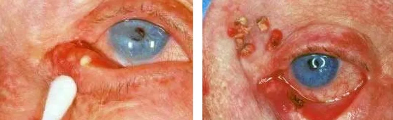 Antibiotics Acinetobacter baumannii is resistant to