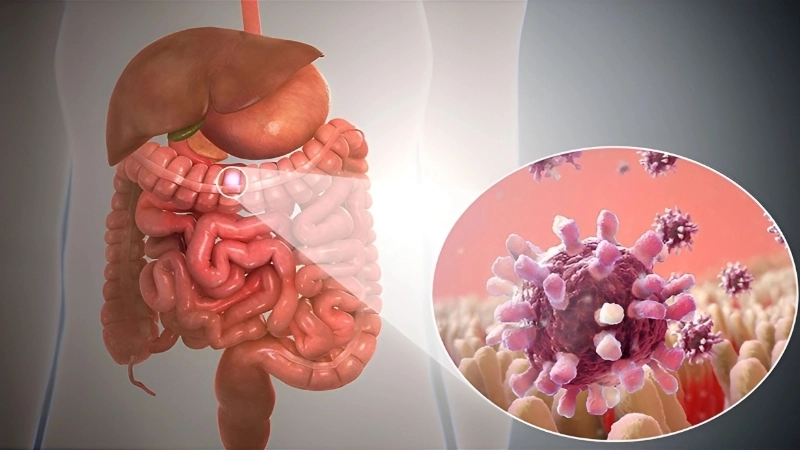 Adenovirus Gastroenteritis nausea issues