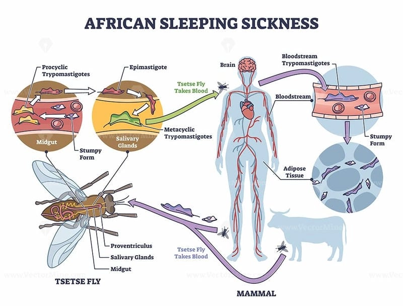 A patient showing tell-tale sleeping sickness symptoms