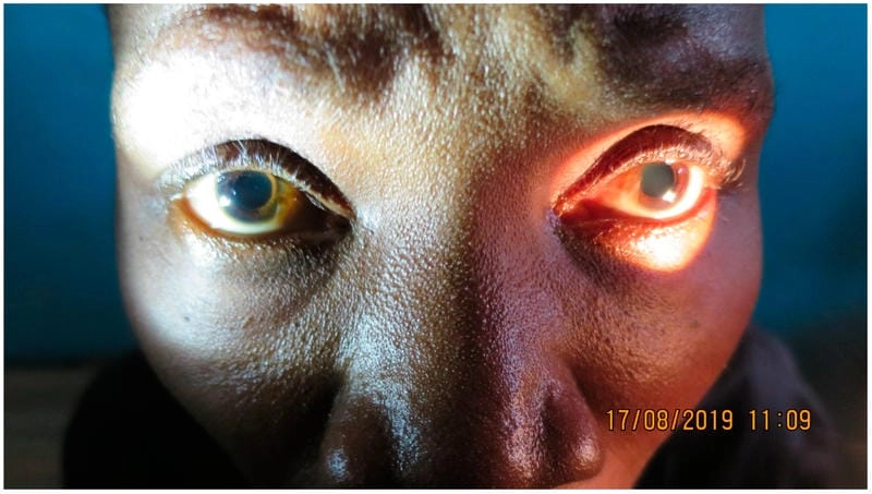 Administering treatment for sleeping sickness in a clinic