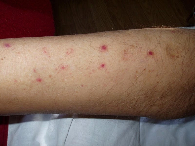 A macro photograph of the tsetse fly vector