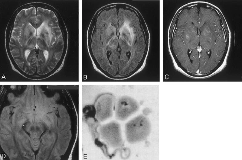 Microscopic view of the parasite Trypanosoma brucei