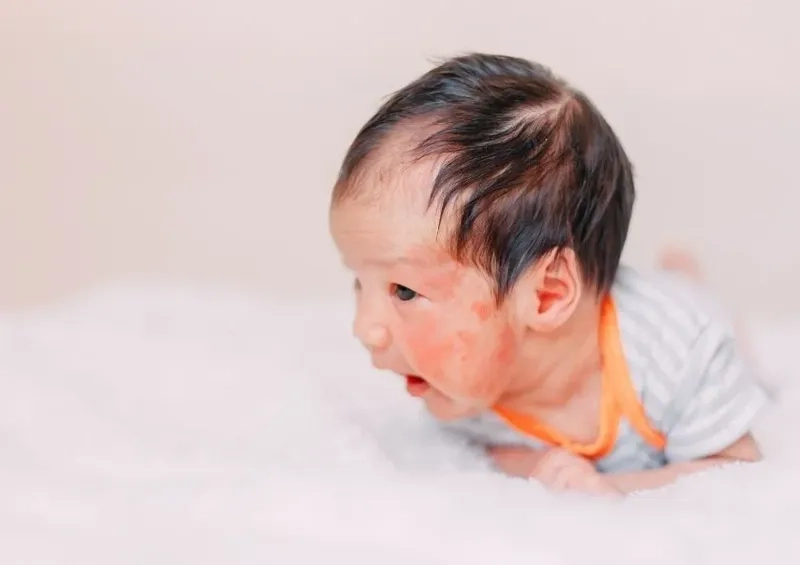 Illustration of post nasal drip condition