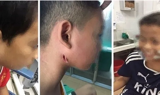 A diagram of the Entamoeba histolytica life cycle