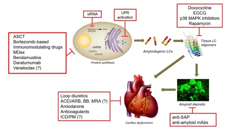 Cardiac amyloidosis life expectancy outlook for affected patients