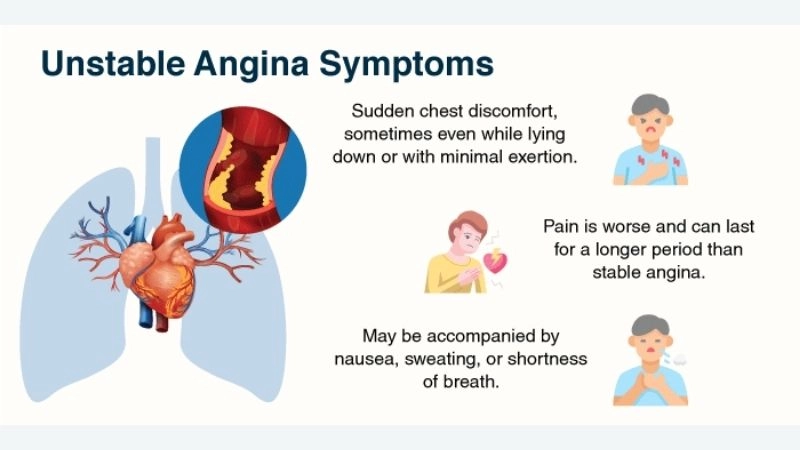 Critical risks of angina pectoris unstable