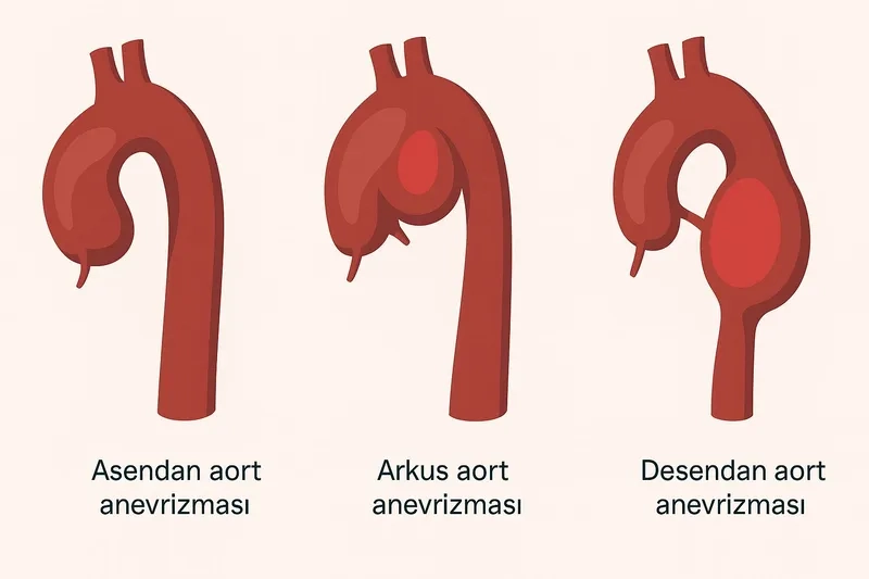Recognizing common aortic aneurysm symptoms