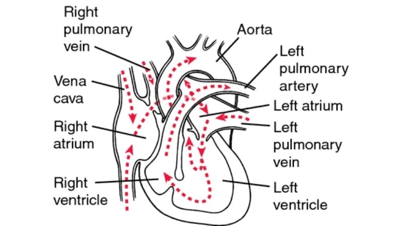 Hypoplastic left heart syndrome and aortic valve atresia link