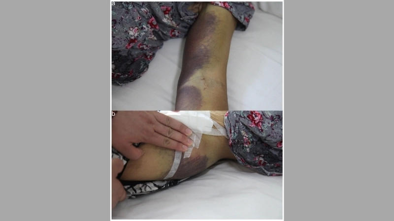 Argentine Hemorrhagic Fever Calomys musculinus host