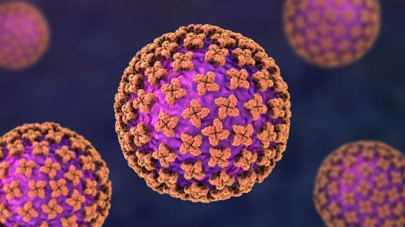 Argentine Hemorrhagic Fever with high fever signs