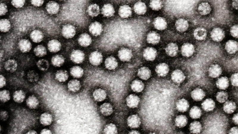 Astrovirus Infection shows astrovirus symptoms
