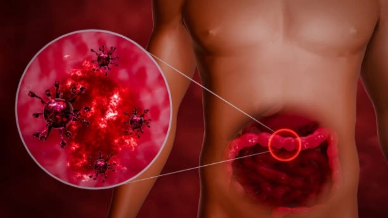 Astrovirus Infection reduced with astrovirus prevention