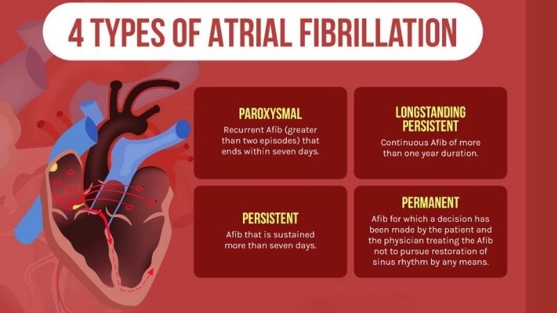 AFib treatment offers hope for heart rhythm control