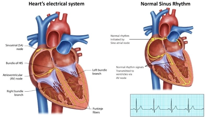 Is atrial flutter dangerous depends on timely treatment