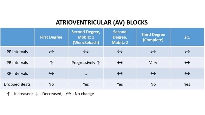 Pacemaker for av block restores steady rhythm