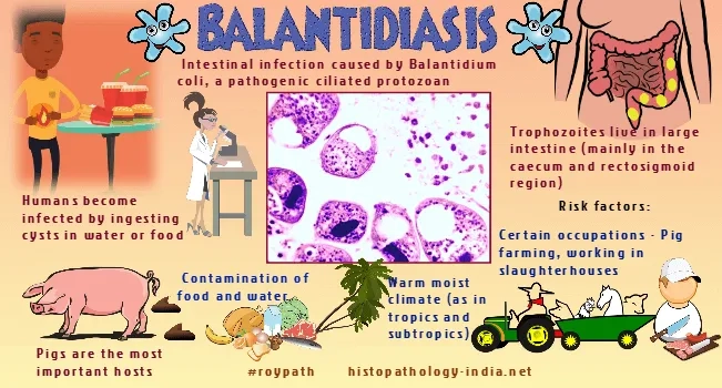 The transmission cycle of a common parasite from pigs