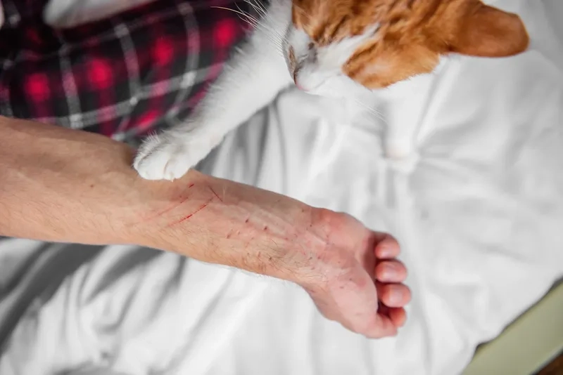 An informational graphic answering 'what is Bartonellosis'