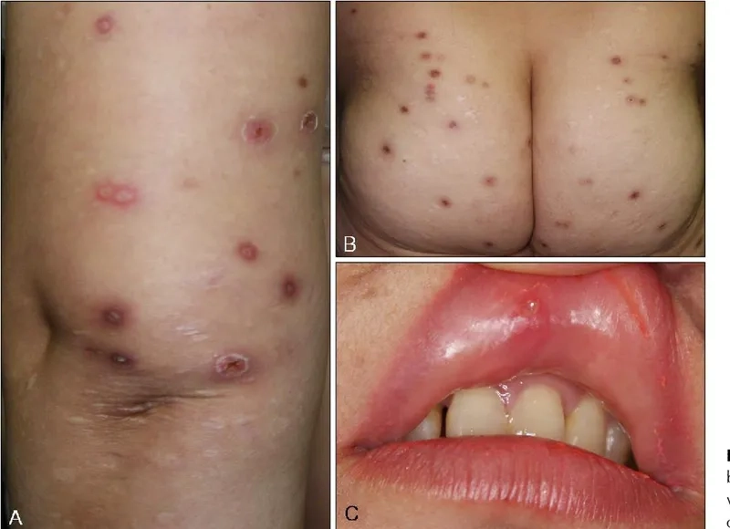 A patient consulting with a rheumatologist