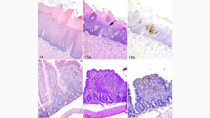 Bolivian Hemorrhagic Fever links to Hantavirus Pulmonary Syndrome