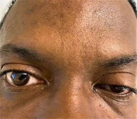 Preventing foodborne botulism in home preserves