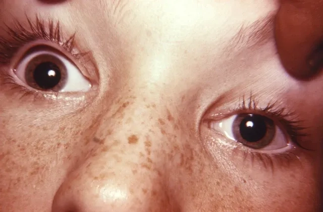 Microscopic view of Clostridium botulinum