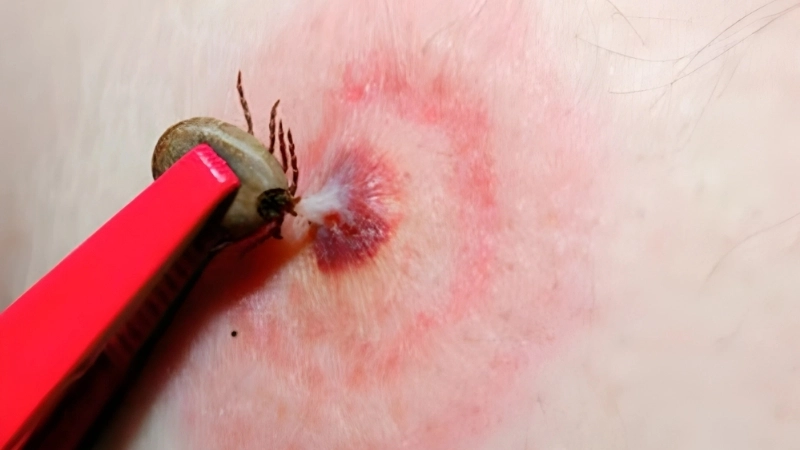 Bourbon Virus Disease spread by Bourbon virus transmission