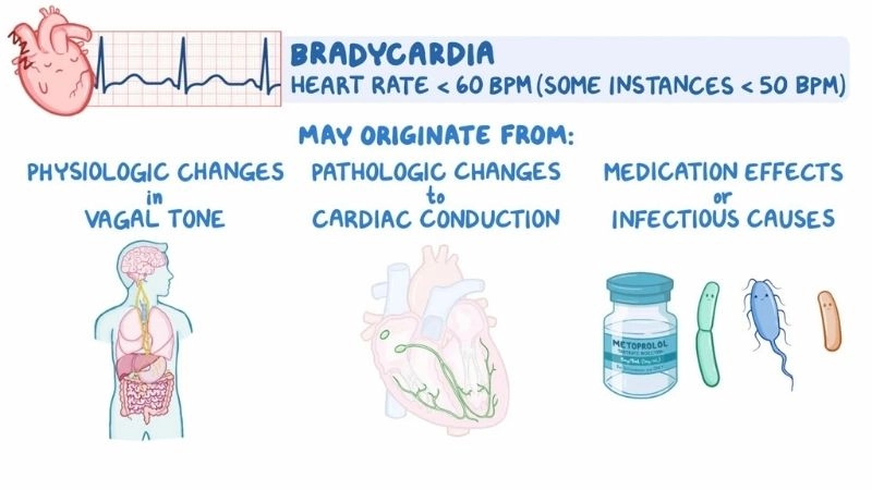 What causes bradycardia ranges from heart disease to medications