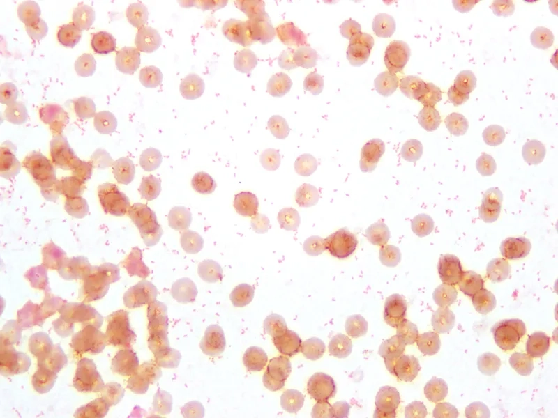A diagram illustrating brucellosis transmission routes