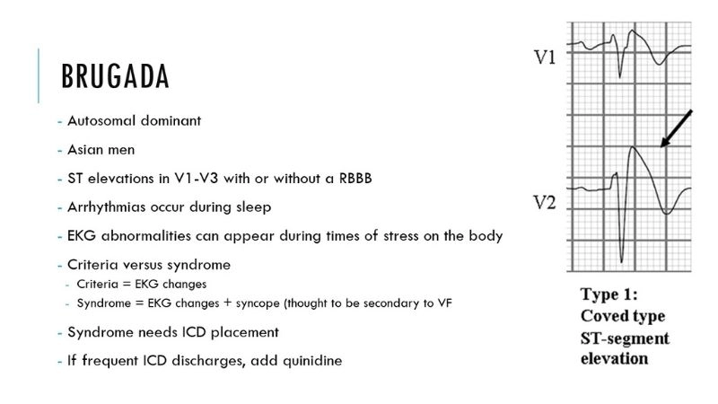 Brugada Syndrome And Fever trigger hidden condition