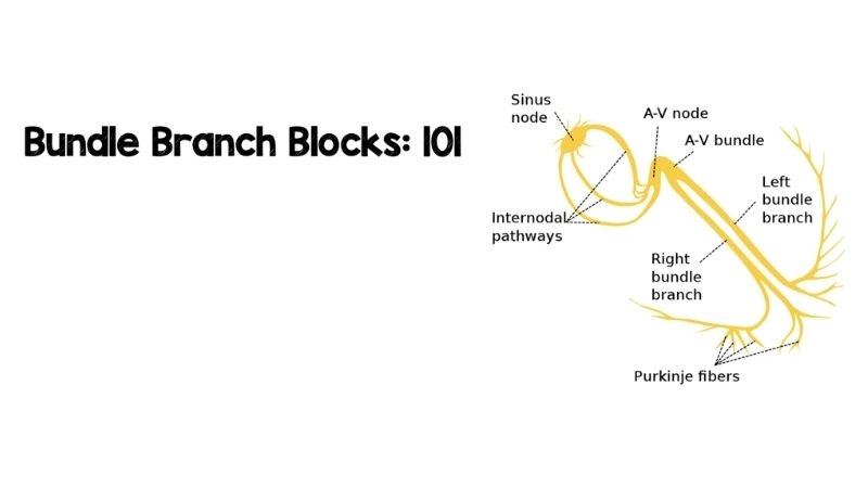 Bundle Branch Block Causes linked to heart weakness