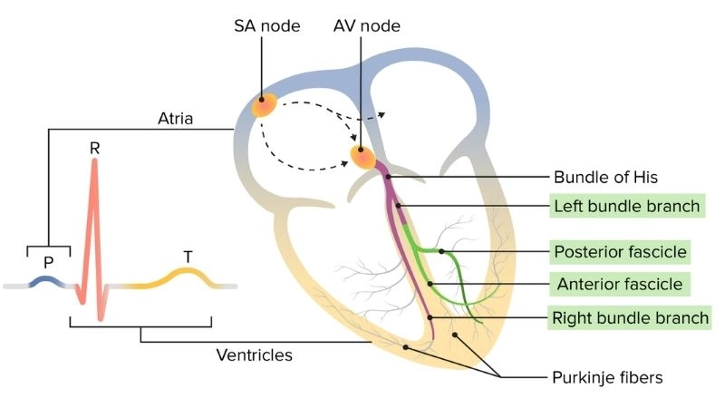 Is Bundle Branch Block Serious check hidden risks