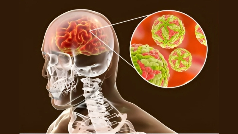 Identify the encephalitis vector in your area