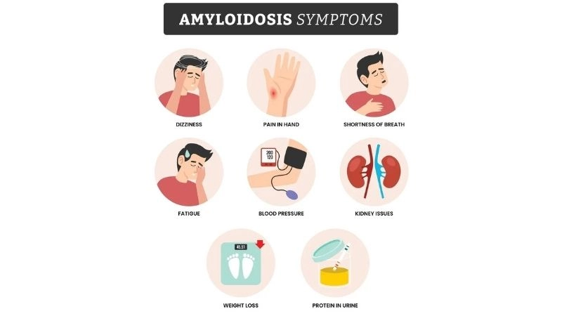 Accurate steps for cardiac amyloidosis diagnosis