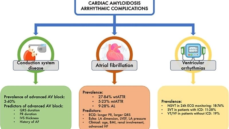 Future outlook of cardiac amyloidosis prognosis