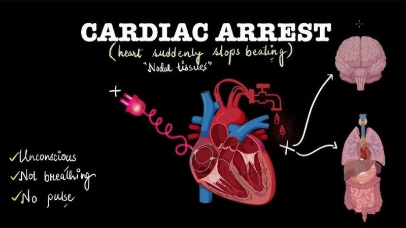 Hopeful journey of cardiac arrest recovery