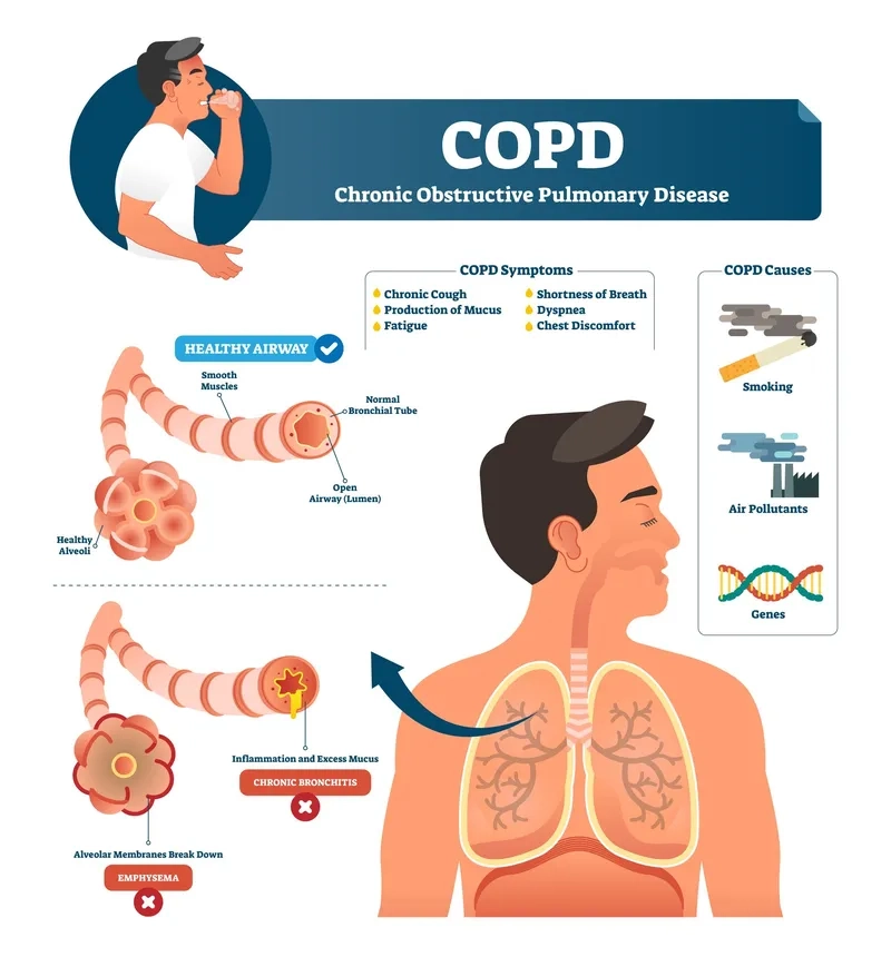 Copd inhalers and breathing support options