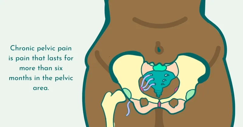 Symptoms overview of chronic pelvic pain syndrome
