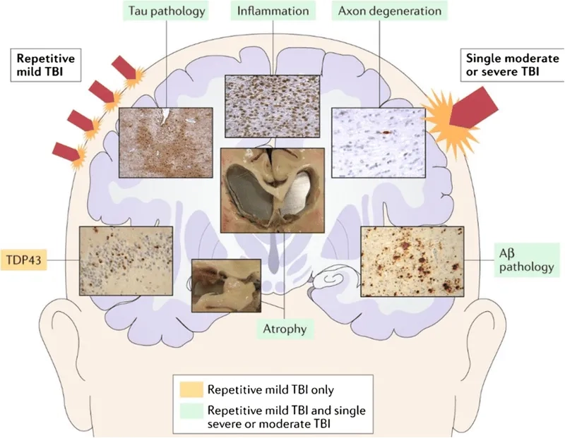 Understanding what causes CTE on a cellular level