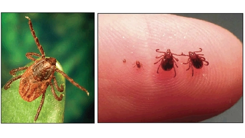 Colorado Tick Fever symptoms to know