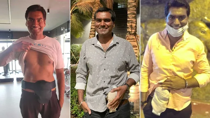 An overview of colorectal cancer treatment