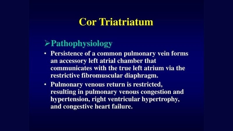 Cor triatriatum treatment medical and surgical management