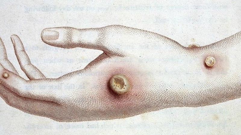 Cowpox virus spreads among animals