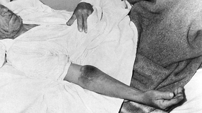 The Hyalomma tick, a primary vector for CCHF