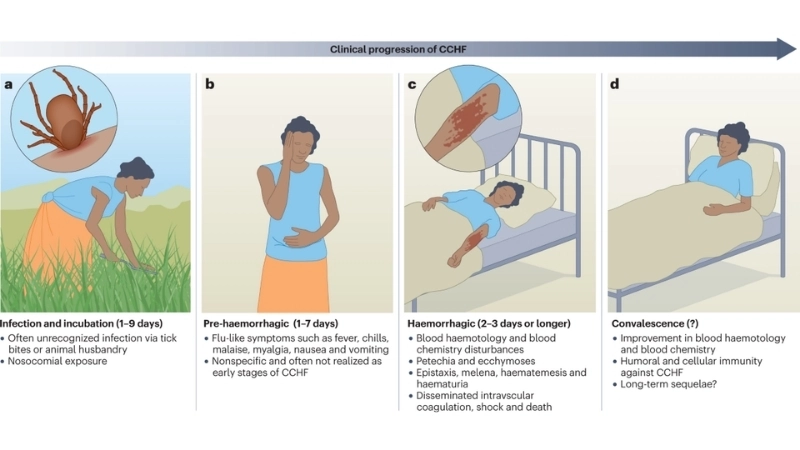 Accurate CCHF diagnosis is vital for control efforts