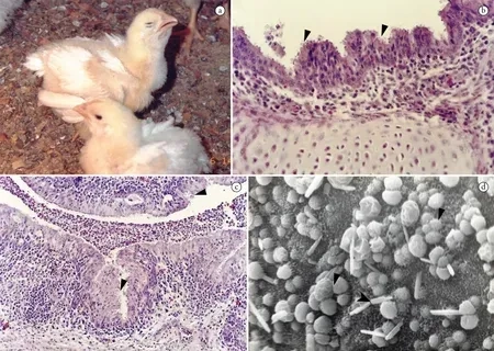 Diagram of the human crypto infection cycle