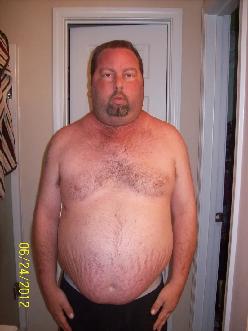 Imaging scan revealing adrenal tumors