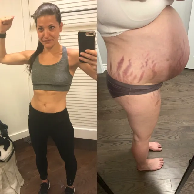 Early Addison's disease symptoms awareness