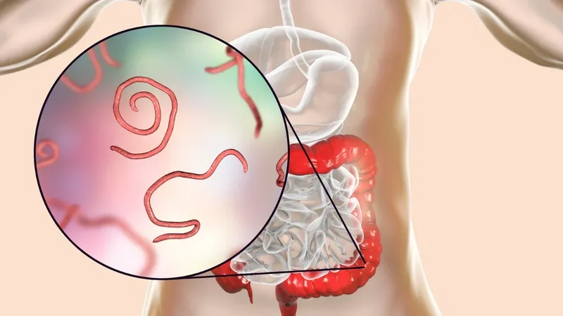 Antibiotics are the primary treatment for cyclosporiasis