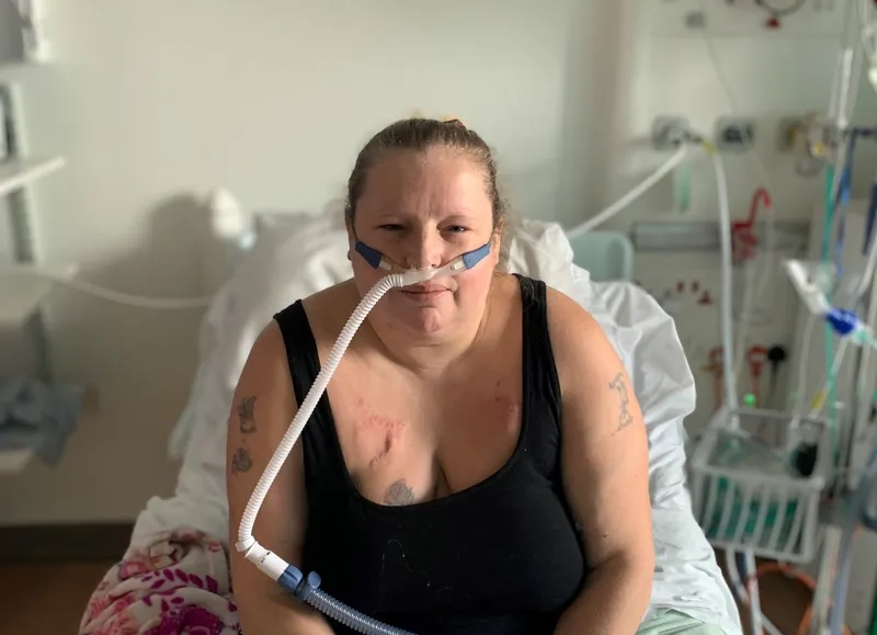 Recognizing signs of cystic fibrosis in babies for action